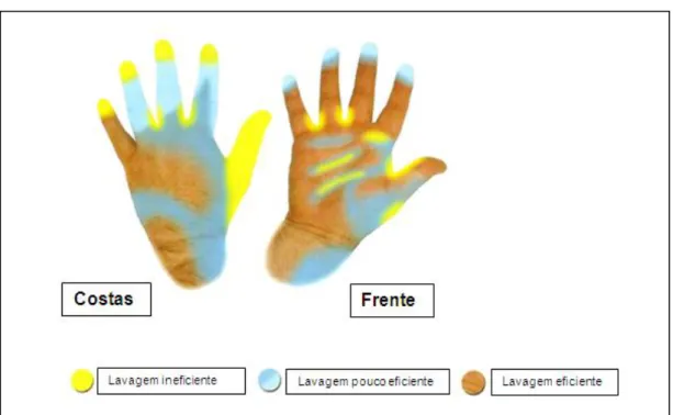 Figura 3. Lavagem de mãos – Avaliação da eficiência da lavagem de mãos. (Fonte: Sprenger, 2009) 