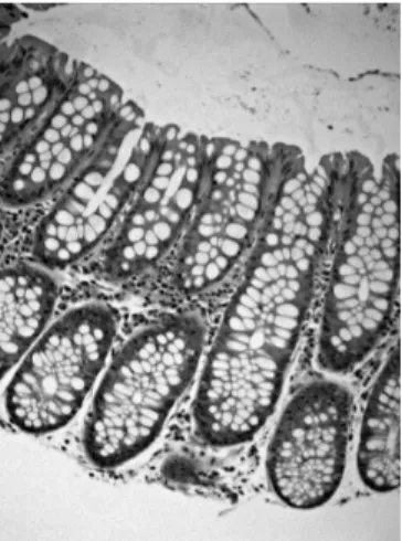 Figura 2.3: Criptas na mucosa normal do cólon, sendo visível o lúmen intestinal no topo da imagem (retirado de Saltz (2002)).