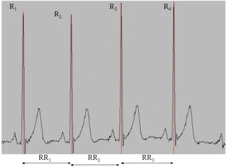 Figura 1. Exemplo de traçado ECG com identificação das ondas R do complexo QRS e respectivos intervalos R-R