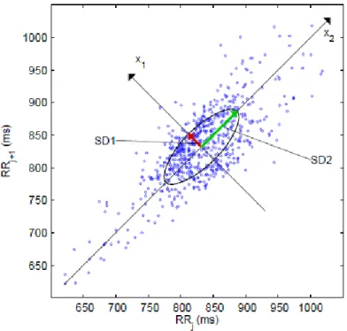 Figura 4 – Exemplo de um pictograma de Poincaré. SD1 e SD2 são os desvios padrões nas direcções x 1  e x 2 , em  que x 2  é a linha de identidade para a qual RR j =RR j+1   