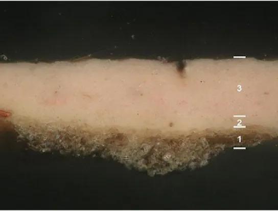 Figura  8.  Estratigrafia  da  carnação  na  zona  da  tonsura  (OM  -  200×):  1  –  preparação; 2 – camada branca; 3 - camada rosada
