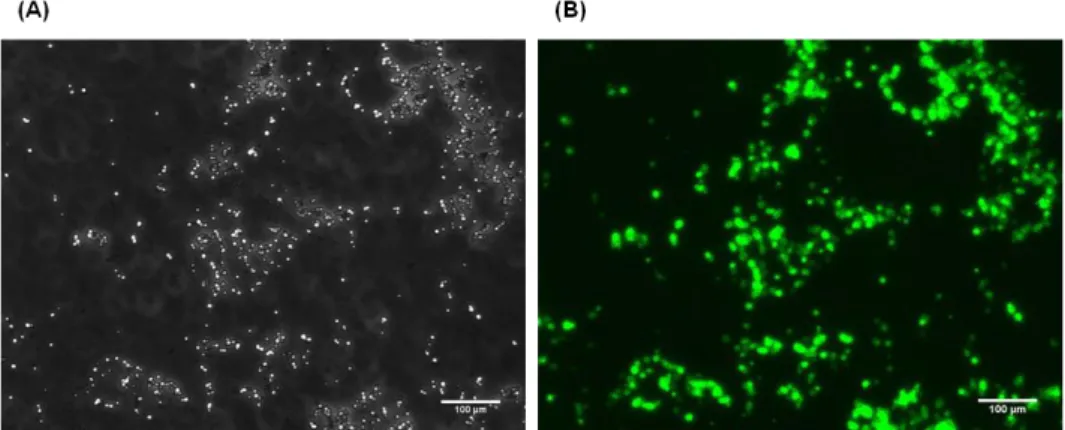 Figure  3.14  Inclusion  bodies  obtained  for  the  WFWFWF-GFP  production  system. The images  were  taken on the fluorescence microscope under (A) bright field filter and (B) fluorescence filter