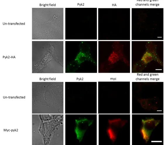 Figure  9  Analysis  of  Pyk2  expression  by  transfected  cells  using  immunofluorescence