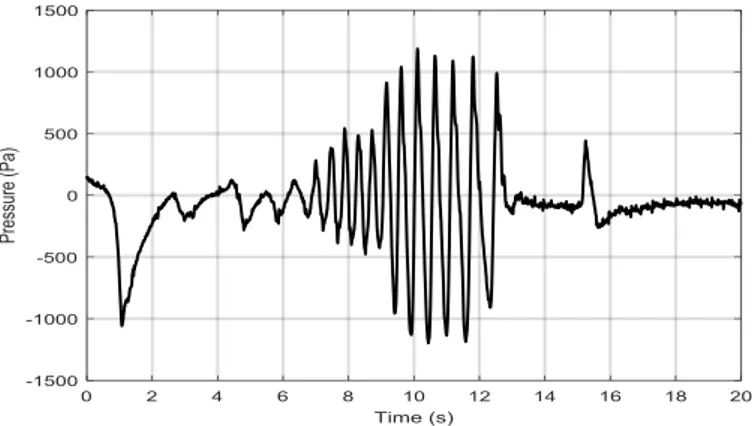 Figure 6. Measurement of a NNS burst (f suction =1,3 Hz; burst duration =7 s; PSA pk =1200 Pa)