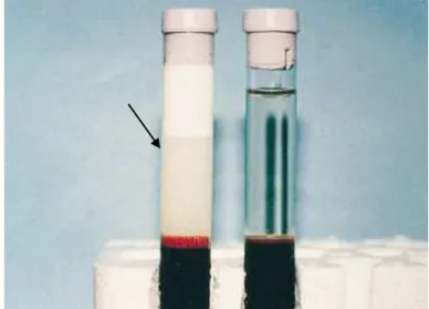 Figura  3  -  Coloração  do  soro  de  um  felídeo  com  hipertrigliceridémia  (esquerda)  após  centrifugação,  em  comparação  com  um  soro  normolipidémico  (direita)