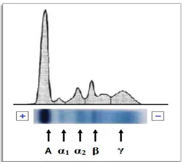 Figura 2. – Perfil electroforético do soro de um indivíduo normal e respectivas  fracções de proteínas