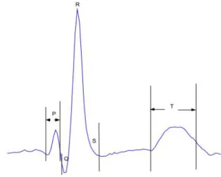 Figura 1: Traçado clássico do ECG.
