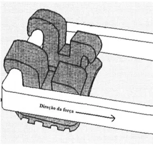 Figura 5- Representação da relação entre o bracket e a ansa utilizada para aplicar a força de cisalhamento  (Modificado de Fox et al, 1994) 