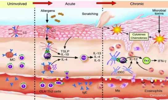 Figura 4: Mecanismo fisiopatológico do eczema agudo e crónico  21