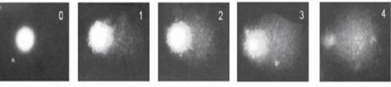 Figura 4 – Imagens de cometas (1–4) obtidos a partir de linfócitos , representativas das classes 0 a 4, por  comparação com uma célula não exposta (Collins, 2004)