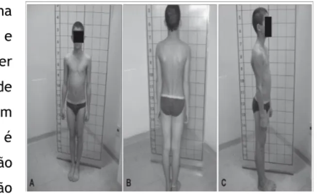 Figura 4 - Técnicas de Correção Postural 