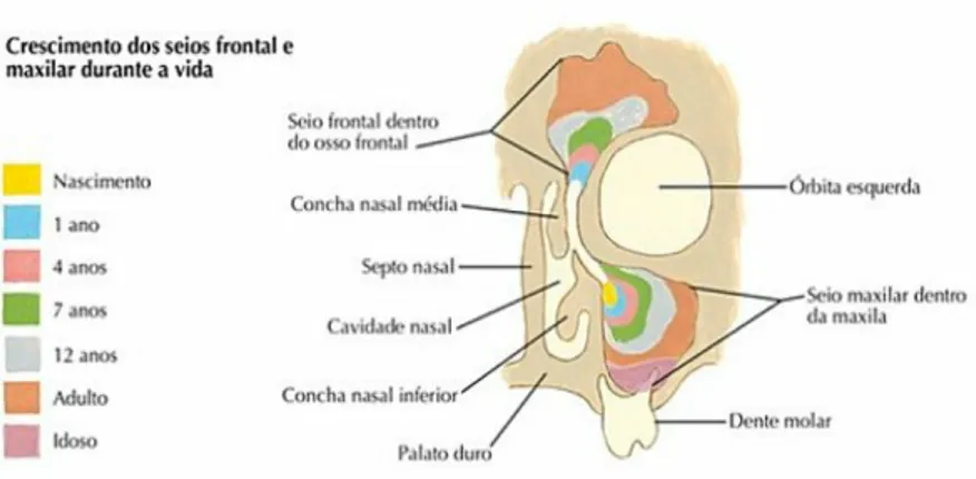 Figura 3 - A pneumatização dos seios frontais e maxilares ao longo da vida. Região nasal (Adaptado a  partir de Netter, 2004)