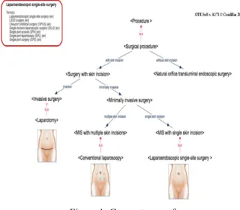Figure 1 depicts the concept of <Laparoendoscopic single- single-site  surgery>  and  aims  to  position  it  within  the  broader  concept of <Surgical procedure> by resorting to a specific  differentiation,  Aristotelian-based  approach