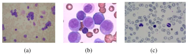 Figure 1 shows examples of blood slide images used in our tests with ALL, AML, and Healthy Blood Slides (HBS).
