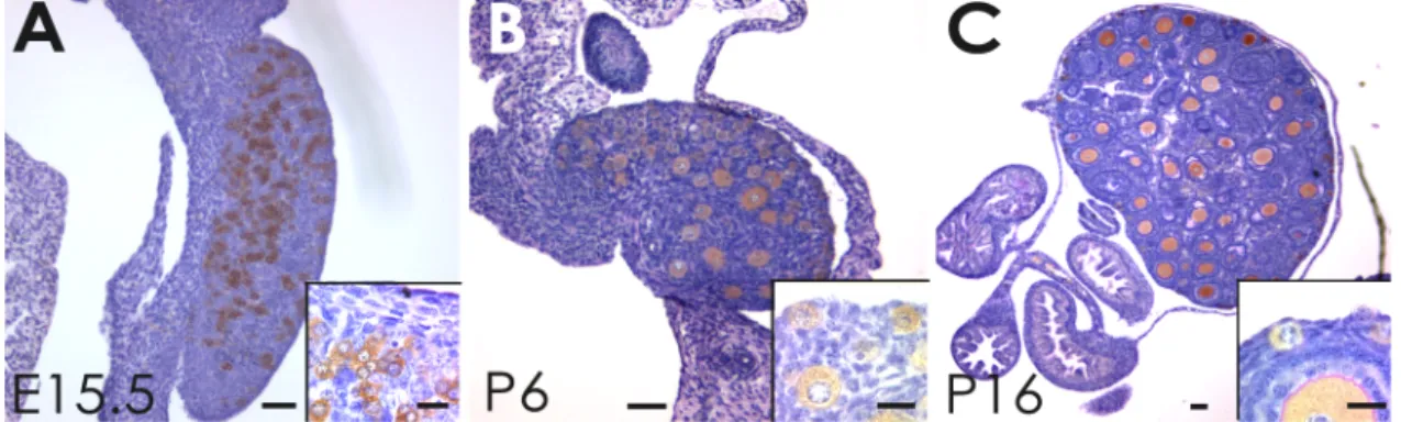 Figure  1.  Germ  cell  disposition  during  ovarian  histogenesis.  MVH  immunocytochemistry  (brown  reaction  product)  defines  developmental  variance  in  germ  cell  density  and  location