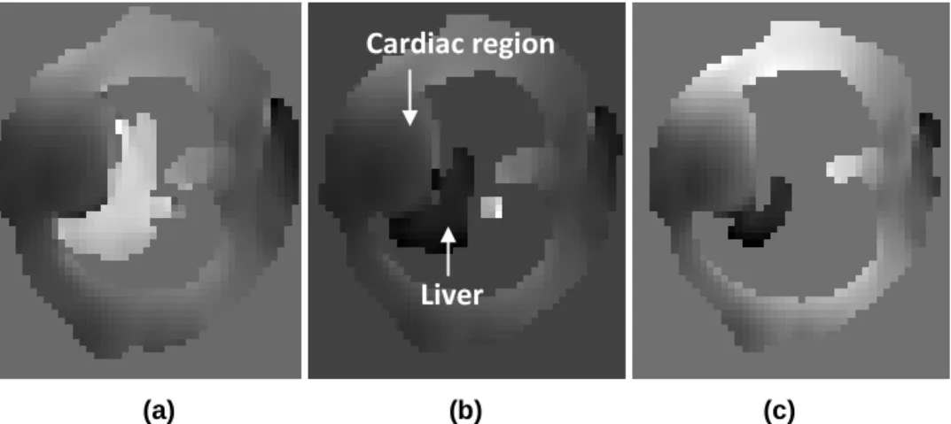 Figure  1  shows  the  results  of  the  increasing  application  of  three  different  threshold  levels:  10% 
