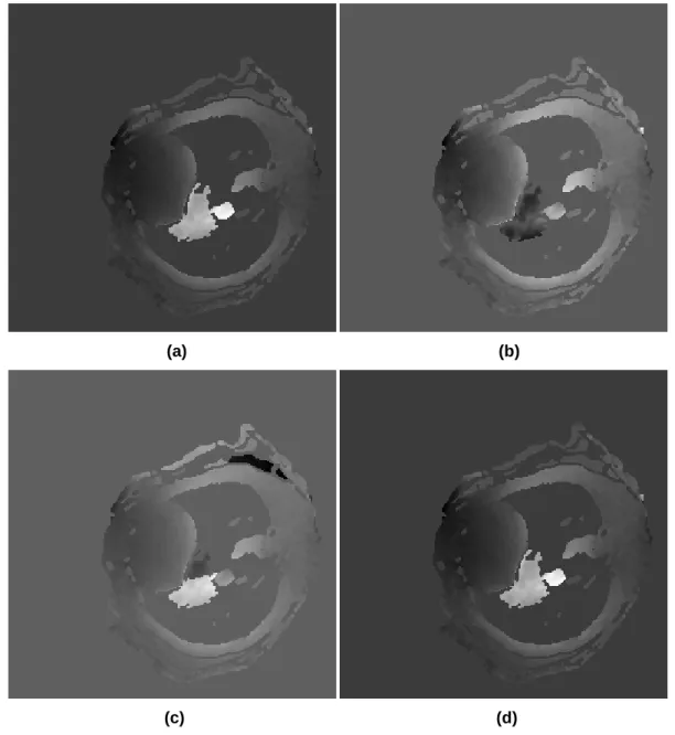 Figure 3. Single dataset representation using the same threshold level (17%) and all options of  phase unwrapping algorithm: 2D (a), 2D + RR (b), 3D (c) and 3D + RR (d)