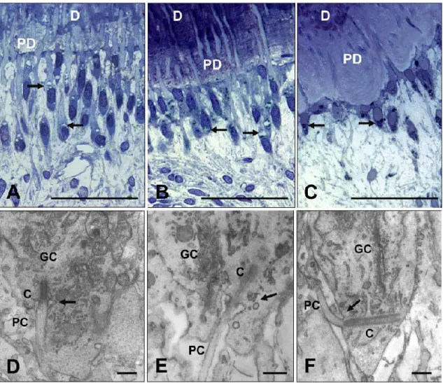 Figura 8.  Odontoblastos maduros em microscopia ótica da camada odontoblástica coronal de pacientes  jovens (15 anos), jovens-adultos (25 anos) e adultos (75 anos) [A-C]