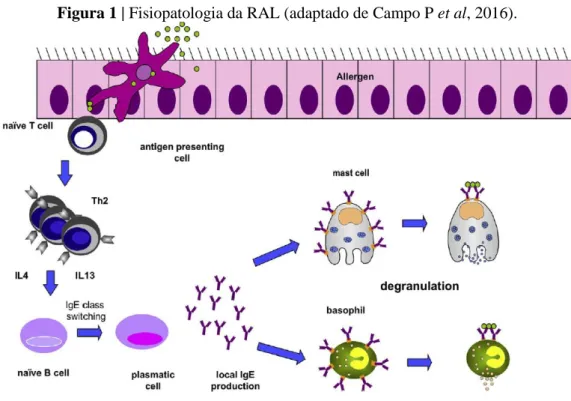 Figura 1 | Fisiopatologia da RAL (adaptado de Campo P et al, 2016). 