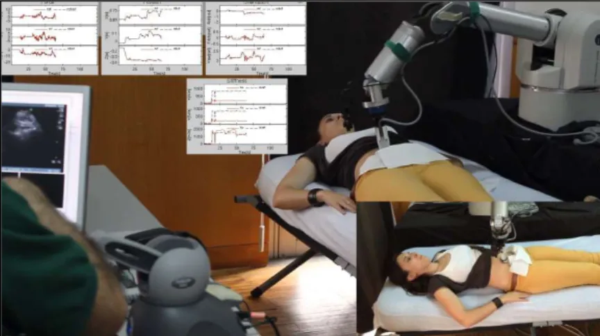 Figure 1-4: Early developments of the ROSE robotic system implemented for a routine ovarian ultrasound diagnostic  procedure