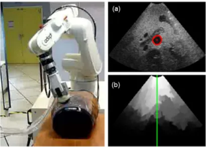 Figure 1-5: Implementation of visual servoing techniques based on both image moments (a) and image quality (b)  for US probe guidance and image optimization in a humanoid phantom