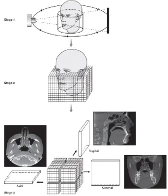 Figura 10 – Representação esquemática dos conceitos básicos de aquisição de uma  CBCT