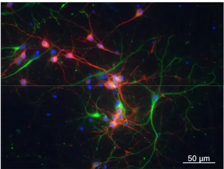 Figure  4.1  -  Primary  cortical  neuronal  culture  with  9  days  in  vitro  in  control  condition