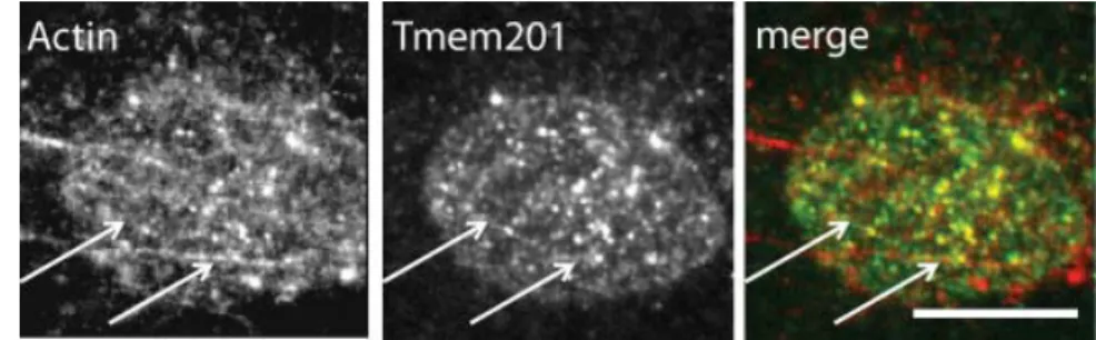 Figure 7. Tmem201 form linear arrays at the nuclear envelope that co-localize with actin dorsal cables