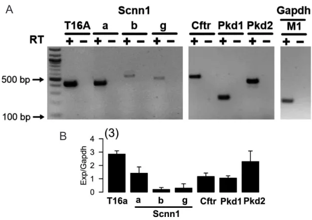 Figure  4.2.  M1  cells    are  a  representative  in  vitro  model  for  ADPKD.  A)  Expression  of  kidney  epithelial  ion  channels (Cftr, Tmem16a, and Scnn subunits) as well as polycystins (Pkd1 and Pkd2) were assessed by RT-PCR