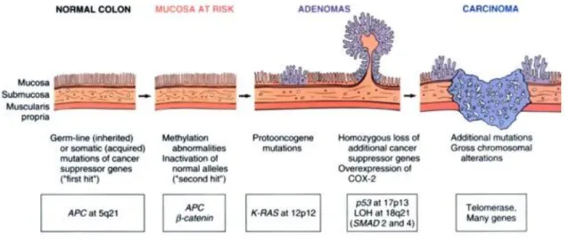 Figura  1:  Schematic  of  the  morphologic  and  molecular  changes  in  the  adenoma-carcinoma sequence