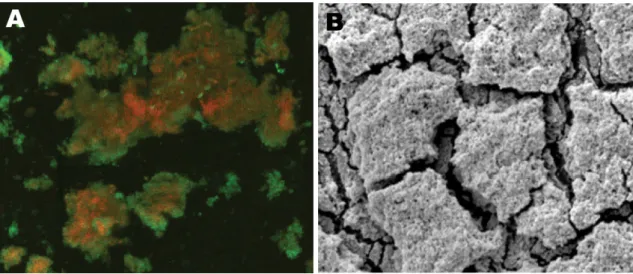Figure 2.3: CLSM and SEM biofilm visualization: A) CSLM image of central venous catheter tip in a patient with Nocardia nova complex central line–associated bloodstream infection (original magnification x25); B) SEM image of central venous catheter tip rev