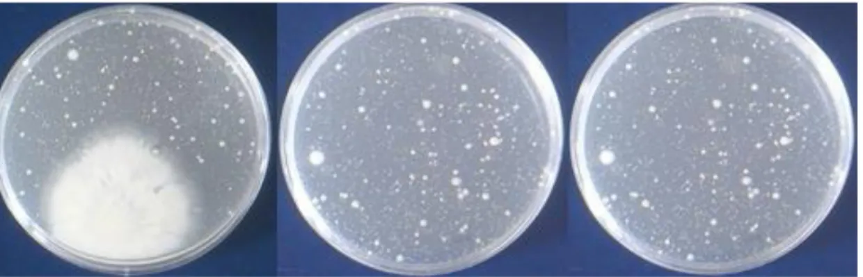 Figura A.5 - Microrganismos presentes nas diferentes águas cinzentas a tratar antes do tratamento de  desinfecção por radiação UV