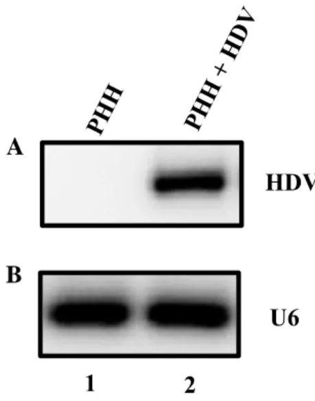 Figura 15: Níveis de expressão do RNA genómico do HDV em hepatócitos primários não infetados  ou infetados com HDV