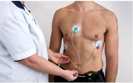 Figura 2.16: Eletrocardiograma (ECG)