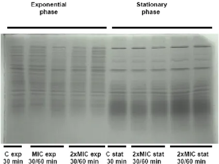 Figure 6. Protein profiles from S. maltophilia  4 cells in the following  conditions: control exp 30 min, MIC exp 30 min, MIC exp 60 min, 2xMIC exp  30min, 2xMIC exp 60 min, control stat 30 min, MIC stat 30 min, MIC stat  60min, 2xMIC stat 30 min, 2xMIC st
