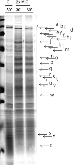 Figure 7. Protein profiles from S. maltophilia 4 cells in the following conditions: control exp 30  min, 2xMIC exp 30 min, 2xMIC exp 60 min