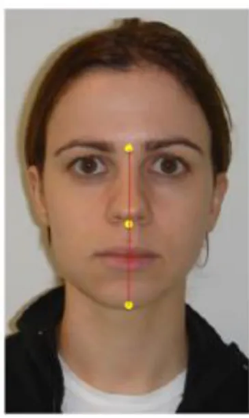 Figura 3 – Pontos anatómicos para a marcação da linha média facial  Fonte: Reis 2010 