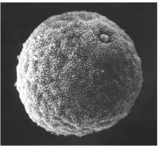 Figura 2 - Micrografia, obtida por microscopia eletrónica, de partícula de pólen. 