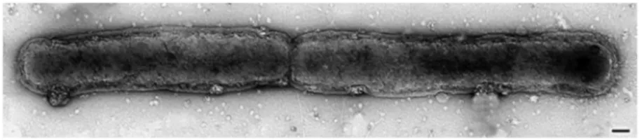 Figura 6 - Xylella fastidiosa ao microscópio de transmissão (Saponari  et al., 2014). 