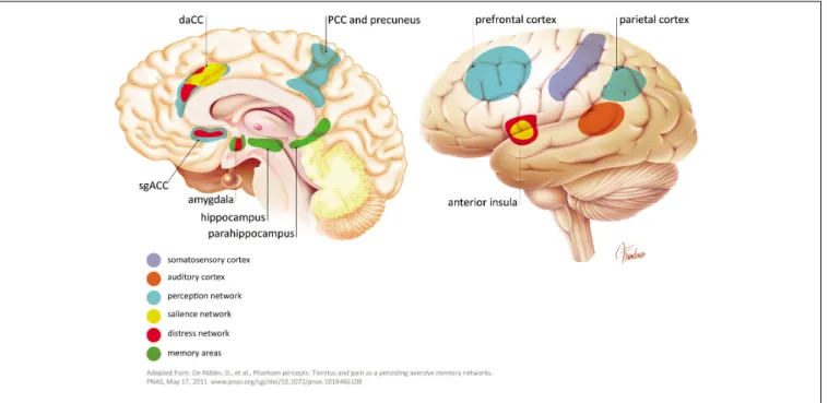 FIGURE 3 | Some extra auditory regions involved in tinnitus pathophysiology.