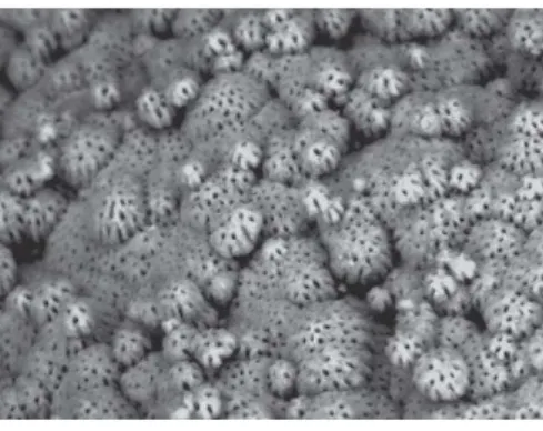 Figura 1- Fotografia ao microscópio eletrónico de varrimento de dentina globular (retirado de Nanci, 2013).