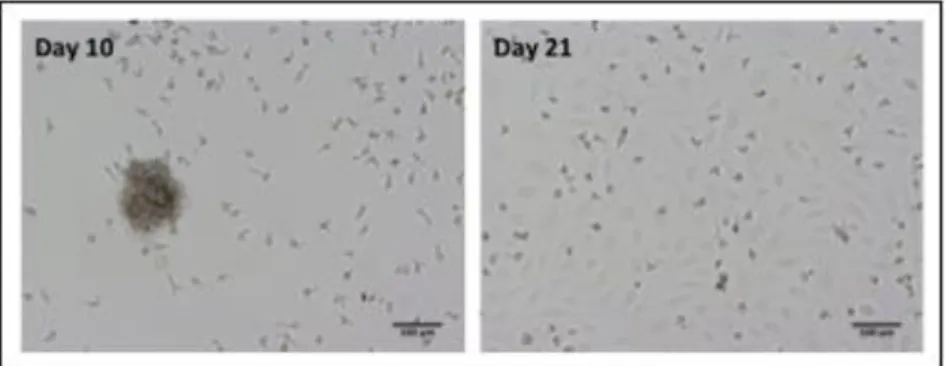 Figure  3.1.  Morphology  of  outgrowth  endothelial  cells  in  culture.  Here,  at  day  10,  OECs  are  differentiating  as  colonies  and  at  day  21  cells  are  confluent  in  the  well,  exhibiting  a  cobblestone-like  phenotype