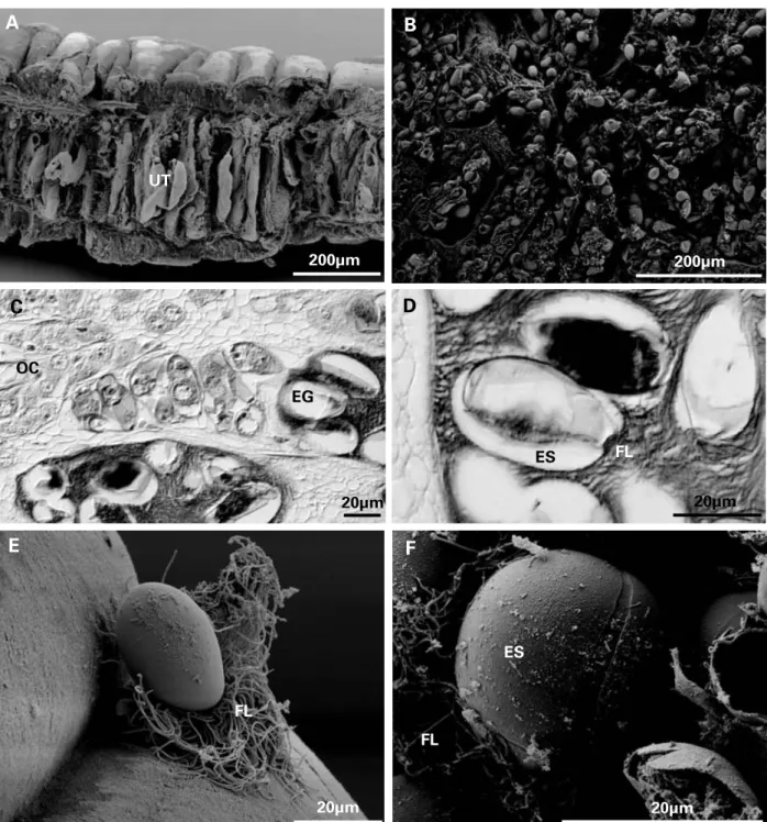 Fig. 7. Scanning electron micrographs and histological sections of the uterus and eggs of Didymobothrium rudolphii collected from Solea lascaris along the Portuguese coast