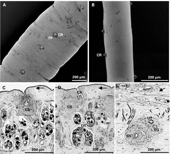 Fig. 4. Scanning electron micrographs and histological sections of the strobila of Didymobothrium rudolphii collected from Solea lascaris along the Portuguese coast