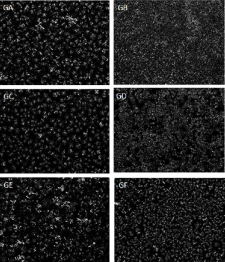 Figure  3  shows  a  characteristic  microstructure  of  the  shortening  samples  containing high and low levels of trans fat