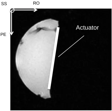 Figure 3.1. Gradient-echo MR image of 0.5% agarose phantom in axial orientation. The picture shows the actuator position and  orientation of MR gradients