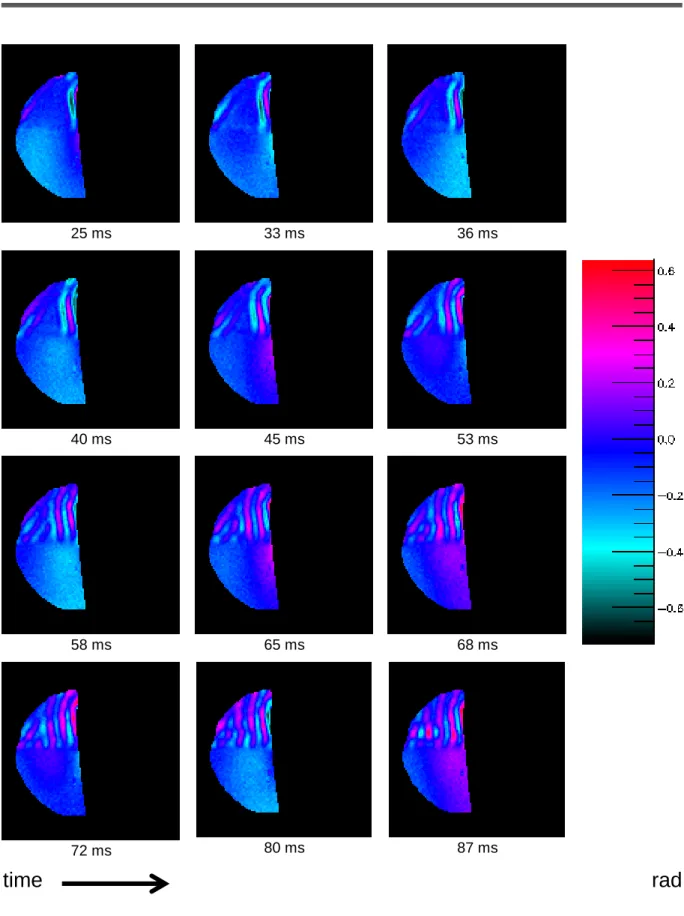 Figure 3.6.  Shear wave propagation into a two-compartment phantom varying over time. The upper part refers to the 0.5% gel  and  the  lower  part  refers  to  the  2%  gel.The  resulting  displacement  image  reflects  shear  wave  propagation  in  a  med