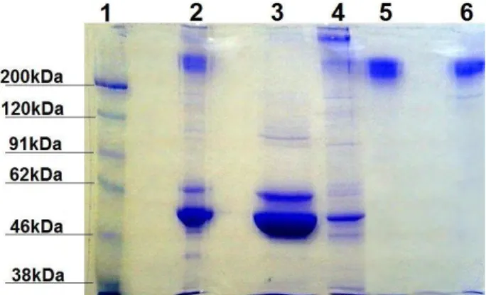 Figura 2 – Eletroforese SDS-PAGE 12,5%: Etapas de  purificação de Imunoglobulina G a partir de soro de 