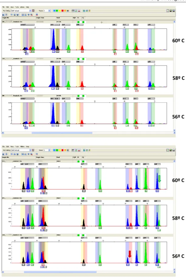 Fig. 2 - PCR annealing temperature optimization. As can be seen in this figure, internal PCR  optimization was achieved with PCR annealing temperature of 58ºC