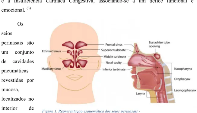 Figura 1. Representação esquemática dos seios perinasais - 